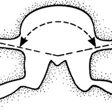Sammle ideen für deinen aufsatz. Pdf Kinematic Imbalances Due To Suboccipital Strain In Newborns And Young Children