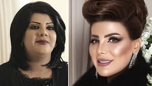 We did not find results for: Ø´Ø§Ù‡Ø¯ Ø§Ù„Ù‡Ø§Ù… Ø§Ù„ÙØ¶Ø§Ù„Ø© Ù‚Ø¨Ù„ ÙˆØ¨Ø¹Ø¯ Ø§Ù„ØªØ¬Ù…ÙŠÙ„ Ù‡Ù„ ØªØºÙŠØ±Øª ÙƒØ«ÙŠØ±Ø§ Ø¬Ø±ÙŠØ¯Ø© Ù†ÙˆØ±Øª