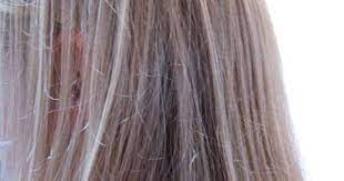 9 Unusual Uses For Aspirin Restore Hair Color Aspirin For Hair Hair Loss Remedies