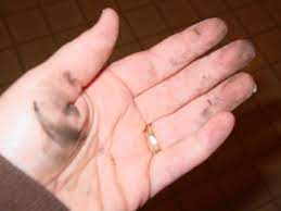 Your first step for getting a red stain out of carpet is to understand the differences between a natural and synthetic stain. How To Get Ash Out Of Carpet And Off Hands Pellet Stove Ash