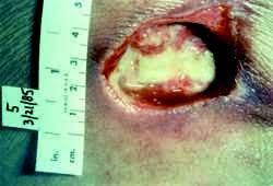 All rights acronyms and abbreviations are used extensively in medicine, science and technology for good. Gsw Definition Of Gsw By Medical Dictionary