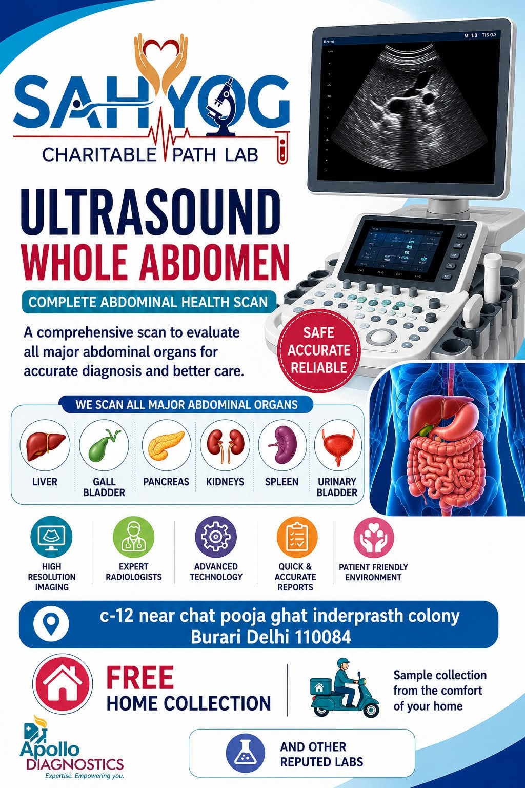 ULTRASOUND WHOLE ABDOMEN