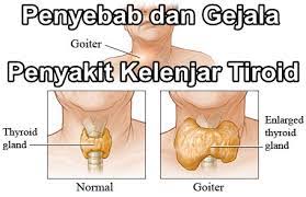 Itulah sedikit pembahasan mengenai obat penyakit crohn sudah parah yang paling tepat dan aman untuk anda konsumsi sebagai bahan untuk pengobatan crohn yang aman tanpa meninggalkan efek samping apapun. Selamat Petang Jom Ketahui Serba Br Herba Resources ÙÙŠØ³Ø¨ÙˆÙƒ