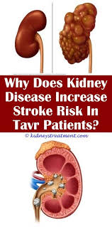 Diabetic Kidney Disease Renal Diet Kidney Disease Symptoms Kidney Disease Diet Kidney Disease Recipes