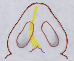 Maybe you would like to learn more about one of these? Septal Deviation Without Clinical Manifestation Desviacion Septal Sin Download Scientific Diagram