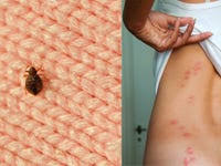 Maybe you would like to learn more about one of these? Flea Bites In Humans How To Treat Them And Get Rid Of An Infestation