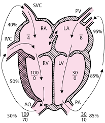 Das herz ist ein muskuläres hohlorgan, das als zentrale pumpstation des kreislaufes die transportvorgänge in allen blutgefäßen antreibt. Transposition Der Grossen Gefasse Tga Padiatrie Msd Manual Profi Ausgabe