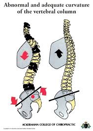 Learn vocabulary, terms and more with flashcards, games and other study upgrade to remove adverts. Abnormal And Adequate Curvature Of The Vertebral Column Englisch Wandtafeln Ackermann Store