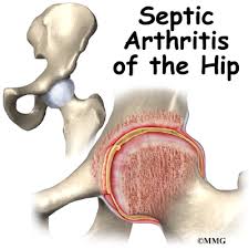 We did not find results for: Conditions And Treatments