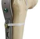 Ortholox® Locking Periprosthetic Support Cable-Plate Systems