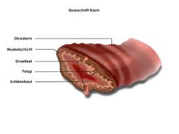 Doch was muss man sich unter einer darmsanierung vorstellen und warum ist diese nach f.x. Darmsanierung Alles Was Du Dazu Wissen Solltest Regenbogenkreis