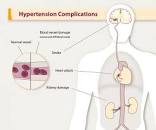 Image result for hypertension