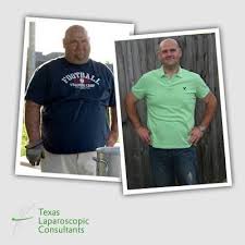 Pin On Wls Patients Featured Stories