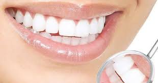 Hastalara anlatıldığında zirkonyum mu porselen mı denildiğinde hasta illaki lamine istiyorum. Lamine Dis Fiyatlari Ne Sekilde Yaptiranlar Memnun Mu Kizlarsoruyor