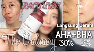 I bought mine from shopee and these are the two sellers that i trust the review is 100% my personal opinion of the product after personally trying it out. Langsung Cerah The Ordinary Aha 30 Bha 2 Peeling Solution Review Novie Marru Youtube