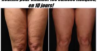 Epingle Sur Body