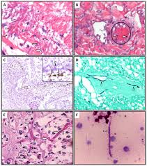 Image result for Pseudoeriosema