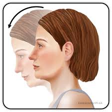 Neck (Cervical Spine)