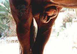 Image result for balanoposthitis