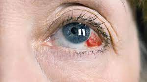 Augen Veranderungen Ernst Nehmen
