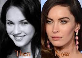 But her before and after photos . Can Button Noses Achieve A Megan Fox Type Rhinoplasty Photos