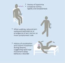 Image result for Rest Tremor