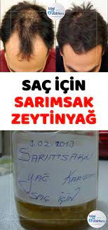 Bu Bitkisel Kur Ile Daha Parlak Ve Guclu Saclara Sahip Olabilirsiniz Sarimsagin Da Zeytinyagi Strong Hair Hair Mask For Damaged Hair Hair Growth Home Remedies