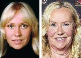 857. 05-04-2025 VANDAAG JARIG Agnetha Fältskog 75 jaar Agnetha en ik zijn  inmiddels wat ouder Toch biecht ik met enige schroom Die blonde van ABBA  was in mijn jeugd Mijn ultieme natte