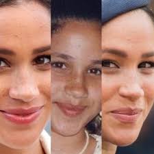 Lots of images may come to mind when you think of plastic surgery. Experts Say Meghan Markle Underwent These Surprising Plastic Surgery Procedures Fun All