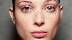 While most moles are harmless and benign, some (especially those that have reared their head and/or grown over time) will require careful monitoring. Should You Get Freckle Tattoos Pics Review Stylecaster