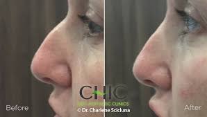 All 22 clinics that provide medical aesthetics in malta ; Chic Med Aesthetic Clinics In Luqa Malta Read 5 Reviews