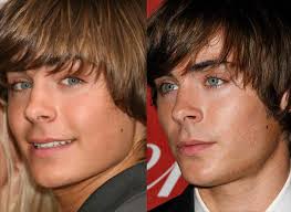 The number of people getting cosmetic procedures has risen steadily over the past five years and there are several reasons why. Male Plastic Surgery For Men Bad Plastic Surgery