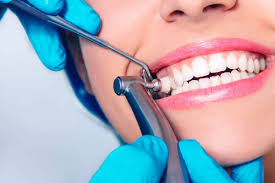 Scaling and Polishing Treatment in Lahore - Alina Dental Clinic