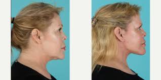 J. Marshall Green, III, DDS Reviews, Before and After Photos, Answers