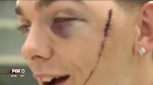 Florida rapper Auztin Blount pka A-Rackz/Raxx @arackzbesnappin speaks