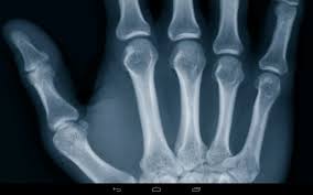 For tumblr, facebook, chromebook or websites. How To Xray Photos On Android How To X Ray Clothes