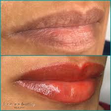 •lip neutralization is perfect for clients who have uneven lip color, cool tone lips, or dark/hyperpigmentation lips. Lip Blushing Houston Tx Bre S Everlasting