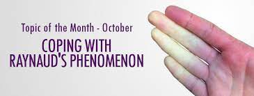 Coping With Raynaud S Phenomenon Lupus Uk
