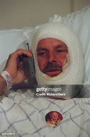 SF.Injured.#3.Rd.10–29–96 Grossman Burn Center at Sherman Oaks... News  Photo