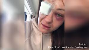 Piękna i niebezpieczna karolina kowalkiewicz: Karolina Kowalkiewicz Po Walce Na Ufc Auckland Strasza Ze Moglabym Stracic Wzrok Youtube