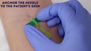 How to use a butterfly needle during venipuncture procedure, a phlebotomist holds the wings of the butterfly needle between the thumb and index finger. Venepuncture Osce How To Take Blood Venipuncture Geeky Medics