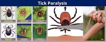Image result for Tick Paralysis
