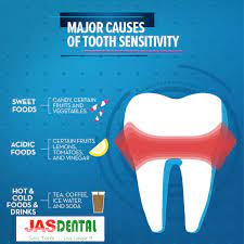 Pin On Dental Information