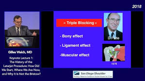 Image result for Shoulder History