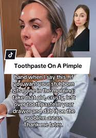 Understanding SPF Levels: Dermatologist Explains Importance of Sunscreen