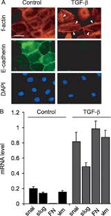 Descriptors are arranged in a hierarchical structure. Joint Requirement For Rac And Erk Activities Underlies The Mid G1 Phase Induction Of Cyclin D1 And S Phase Entry In Both Epithelial And Mesenchymal Cells Journal Of Biological Chemistry