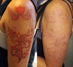 Få 8.000 endnu en scarification artist body modification process stockvideo på 50 fps. Body Art For Teens And Adolescents Talk It Out First The Dca Page