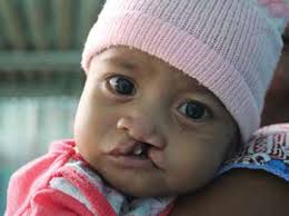 REPAIRING BODIES AND REBUILDING LIVES IN THE ASIA PACIFIC REGION