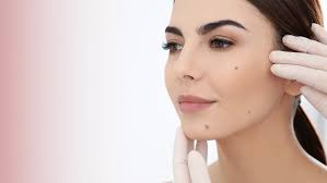 Ben (Nevüs) Nedir? Her Ben Tedavi Edilmeli midir?