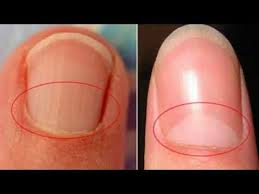 pin on aaa in box processing